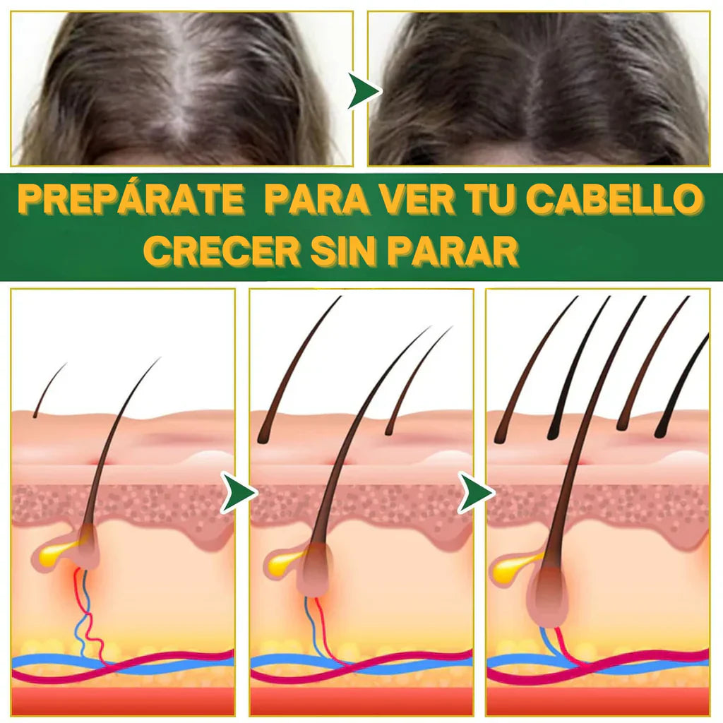ELIXIR CAPILAR ANTICAIDA 2X1