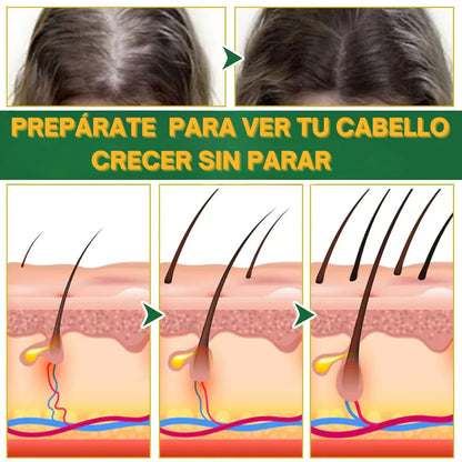 ELIXIR CAPILAR ANTICAIDA 2X1